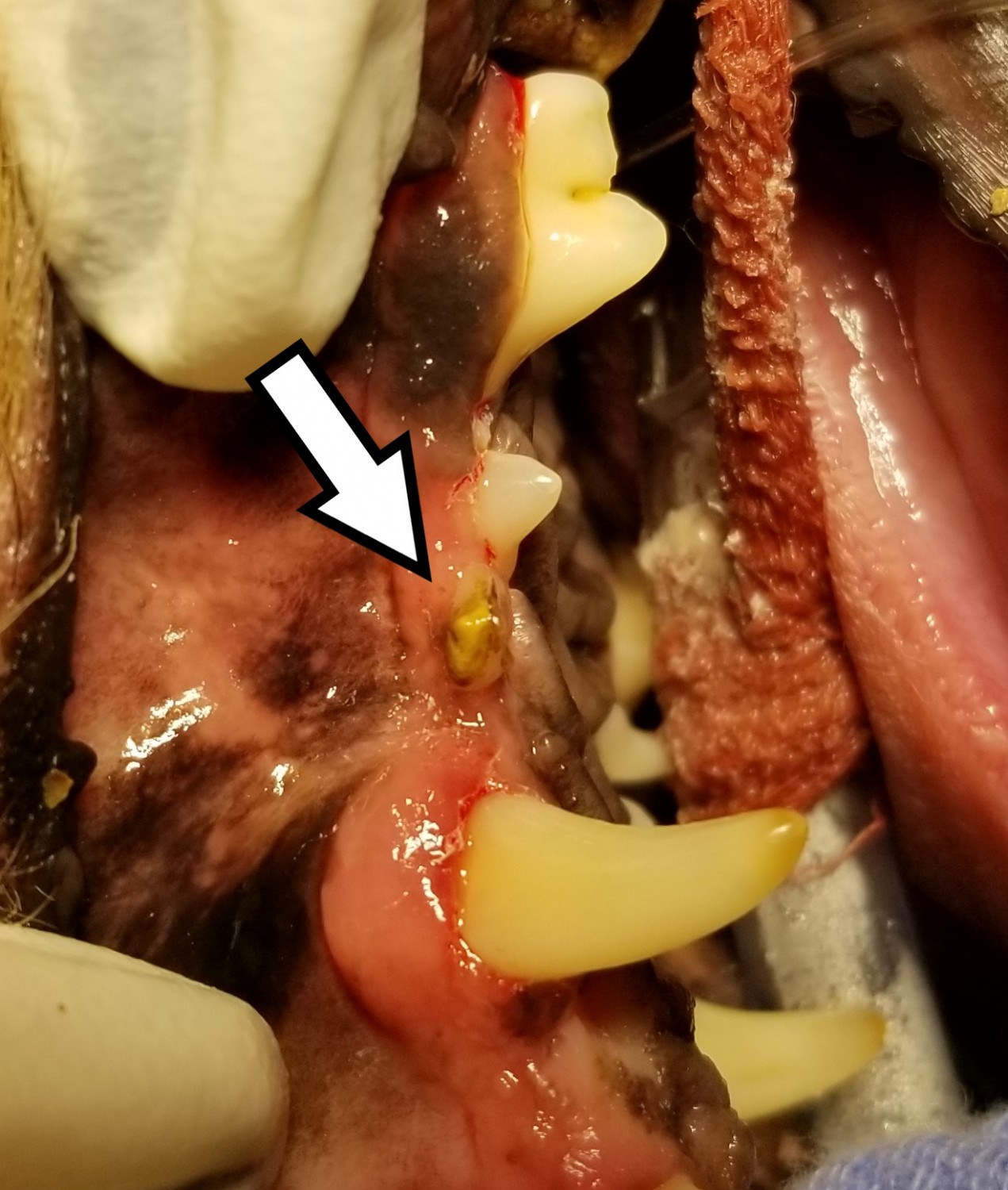 Without taking radiographs, it appears to be calculus buildup on the tooth