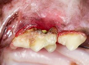 Periodontal disease Vin article